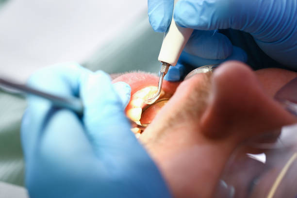 Best Urgent Tooth Repair  in Delafield, WI